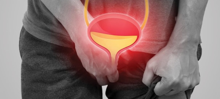 Solusi Revolusioner untuk Pengobatan Prostatitis di Indonesia – Kembalikan Kesehatan Anda Hari Ini Juga!